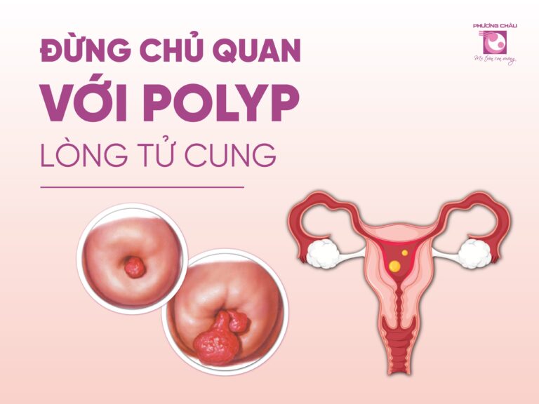 POLYP LÒNG TỬ CUNG – KẺ THẦM LẶNG ẢNH HƯỞNG SỨC KHỎE SINH SẢN