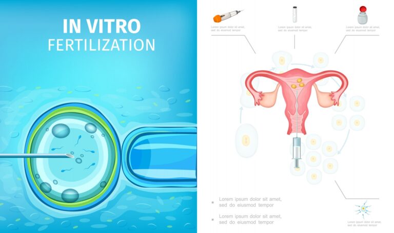IVF là gì? Được chỉ định khi nào?